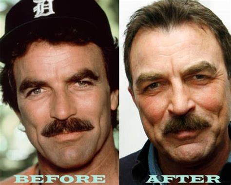 <p>JavaScript is required. . Tom selleck knee surgery